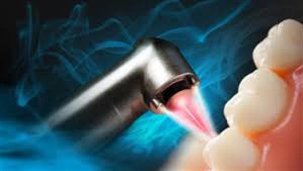 تولید دستگاه لیزر جراحی دهان و دندان برای نخستین بار در کشور آغاز می شود